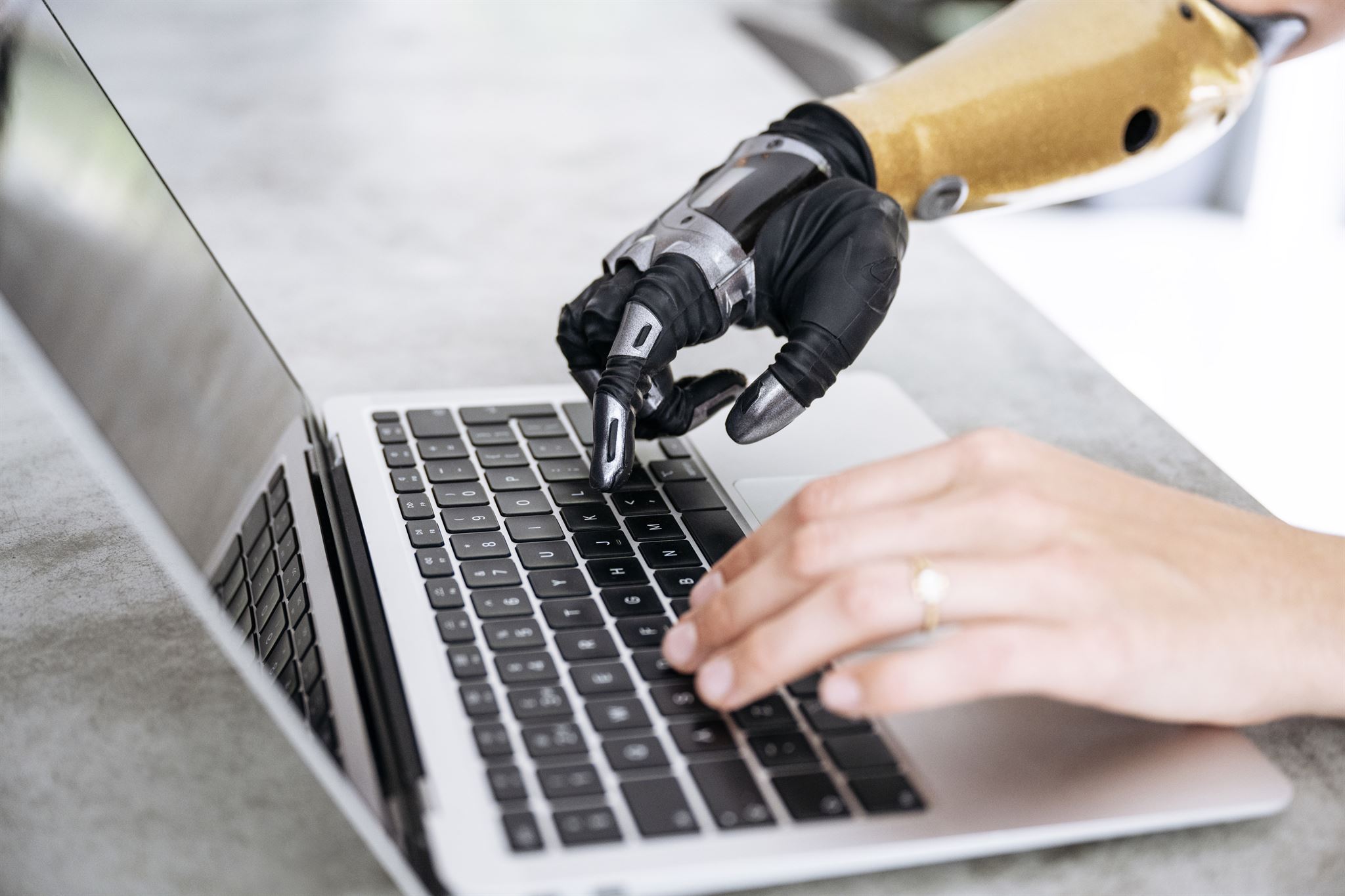 Close-up-of-person-with-bionic-hand-using-laptop
